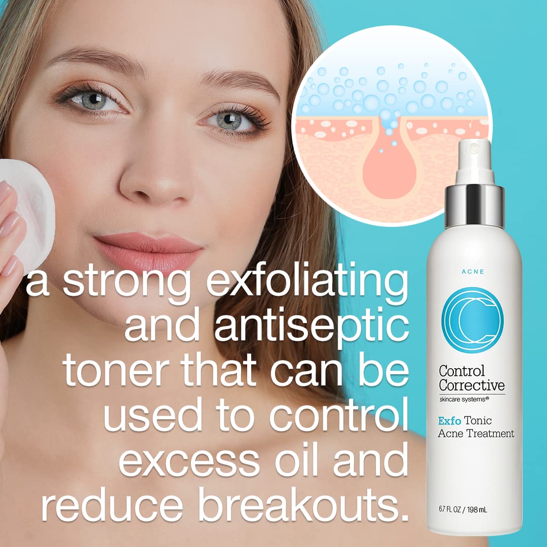 6.7 Fl Oz Exfoliating Acne Treatment Toner J397806